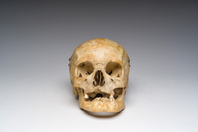 Un cr&acirc;ne d'&eacute;tude ancien et plusieurs fragments d'os