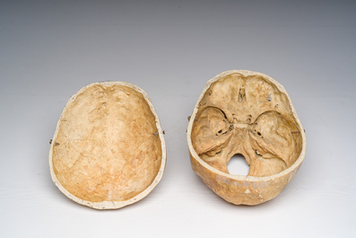 Un cr&acirc;ne d'&eacute;tude ancien et plusieurs fragments d'os