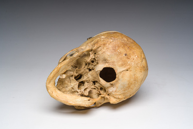 Un cr&acirc;ne d'&eacute;tude ancien et plusieurs fragments d'os