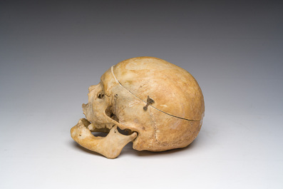 Un cr&acirc;ne d'&eacute;tude ancien et plusieurs fragments d'os