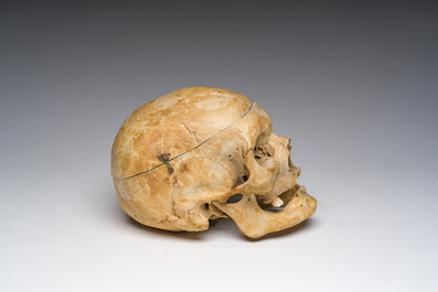 Un cr&acirc;ne d'&eacute;tude ancien et plusieurs fragments d'os