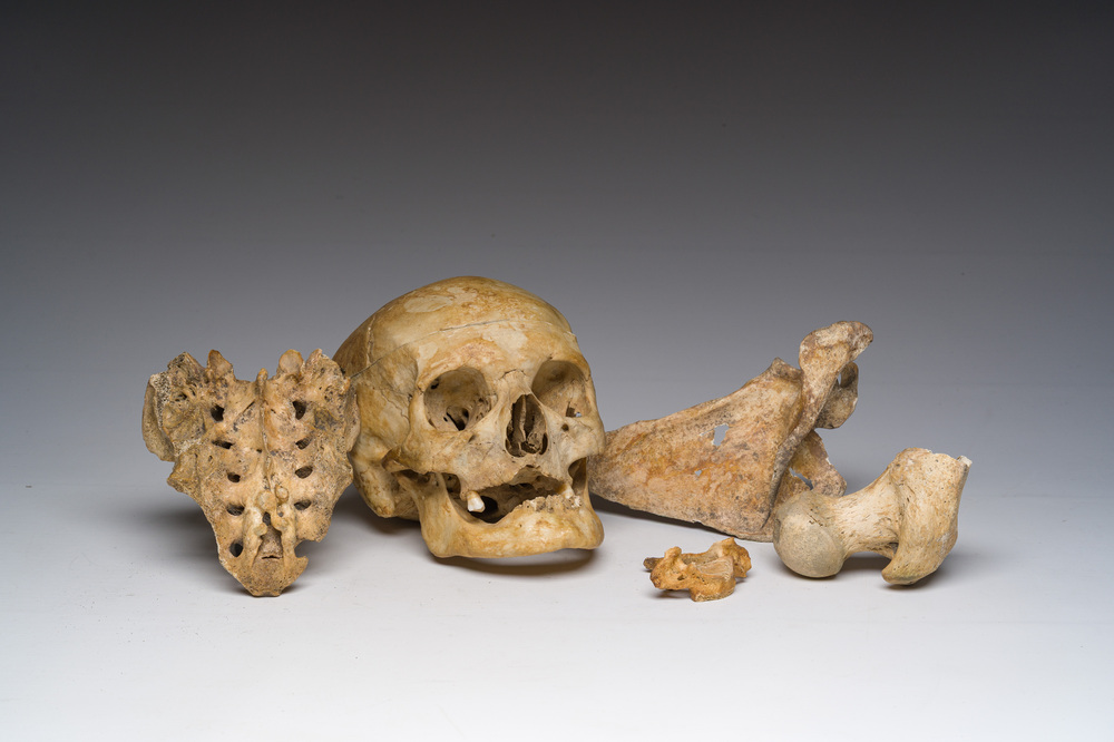 Un cr&acirc;ne d'&eacute;tude ancien et plusieurs fragments d'os