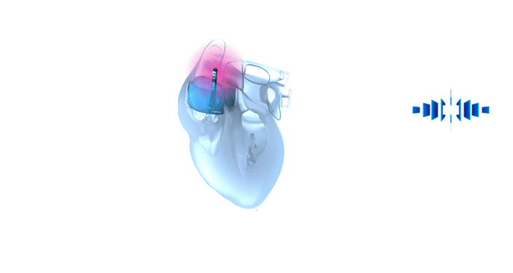 Lighting the Path to Successful Cardiac Surgeries